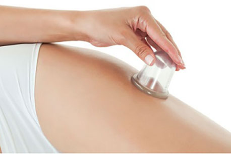 Anti-Cellulite Cupping Massage